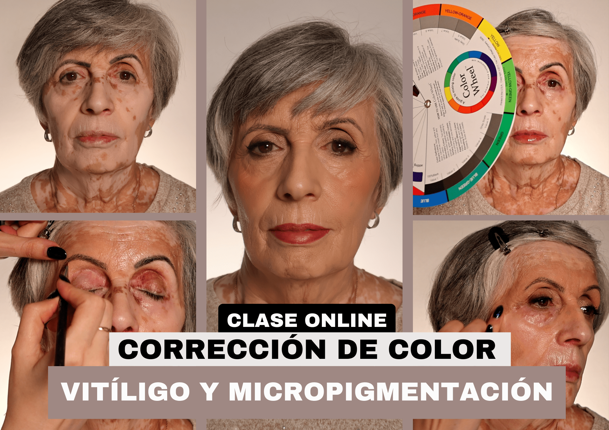 Maquillaje correctivo: vitíligo y micropigmentación antigua